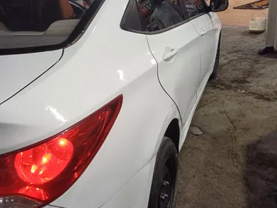 2015 هيونداي اكسنت